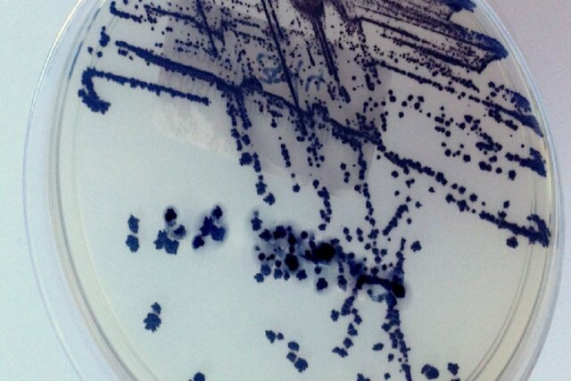 درآمد میلیونی با اهدای مدفوع!
